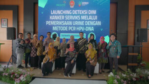 Cegah Kanker Serviks Sejak Dini : Bio Farma dan Pemda DIY luncurkan Cerviscan